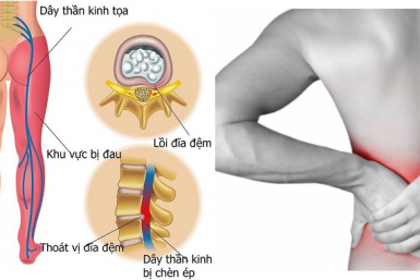 Viên xương khớp Vương Hoạt Viên xương khớp Vương Hoạt